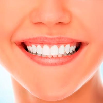 Cosmetic-Dentistry Professional teeth whitening in North Edmonton