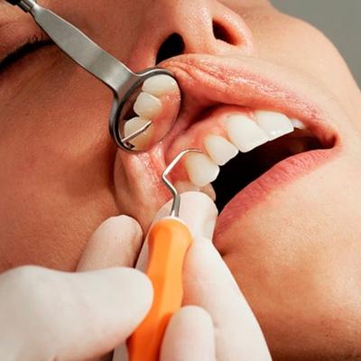 Periodontal-Care - Professional teeth whitening in North Edmonton
