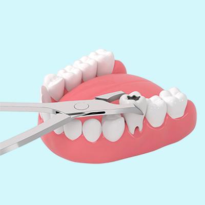 extraction Professional teeth whitening in North Edmonton